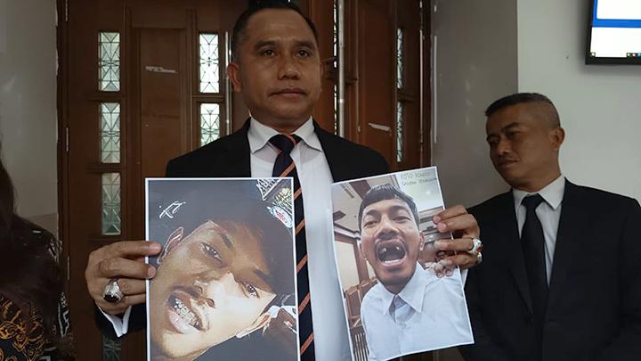 Kengerian Penyiksaan: Jejak Luka di Balik Tanda Tangan BAP